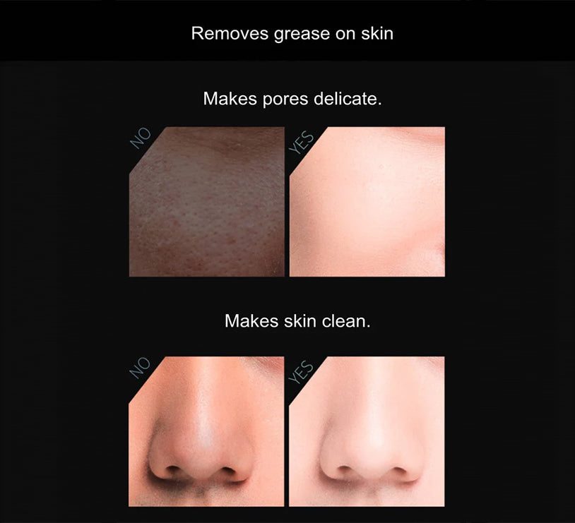 Volcanic Stone Natural Oil-Absorbing Face Roller